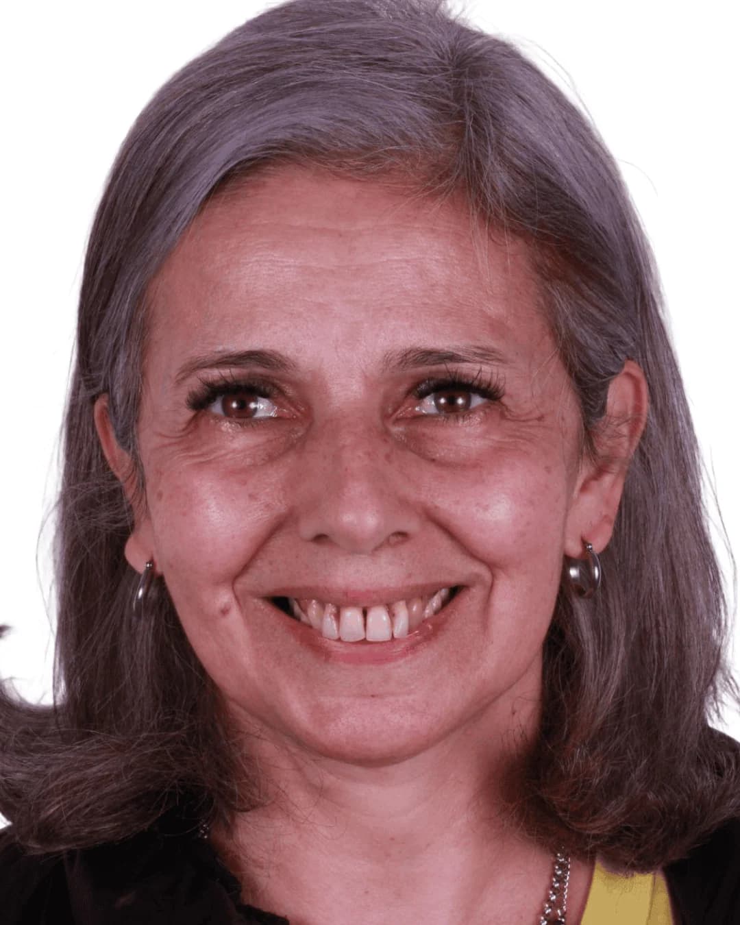 Diseño de sonrisa con carillas cerámicas antes y después — AM Estética Dental