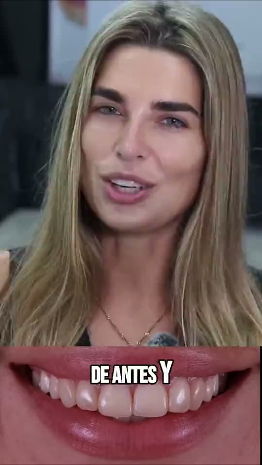 Testimonio en video de un paciente de AM Estética Dental