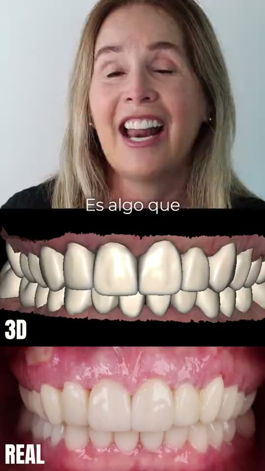 Testimonio en video de un paciente de AM Estética Dental