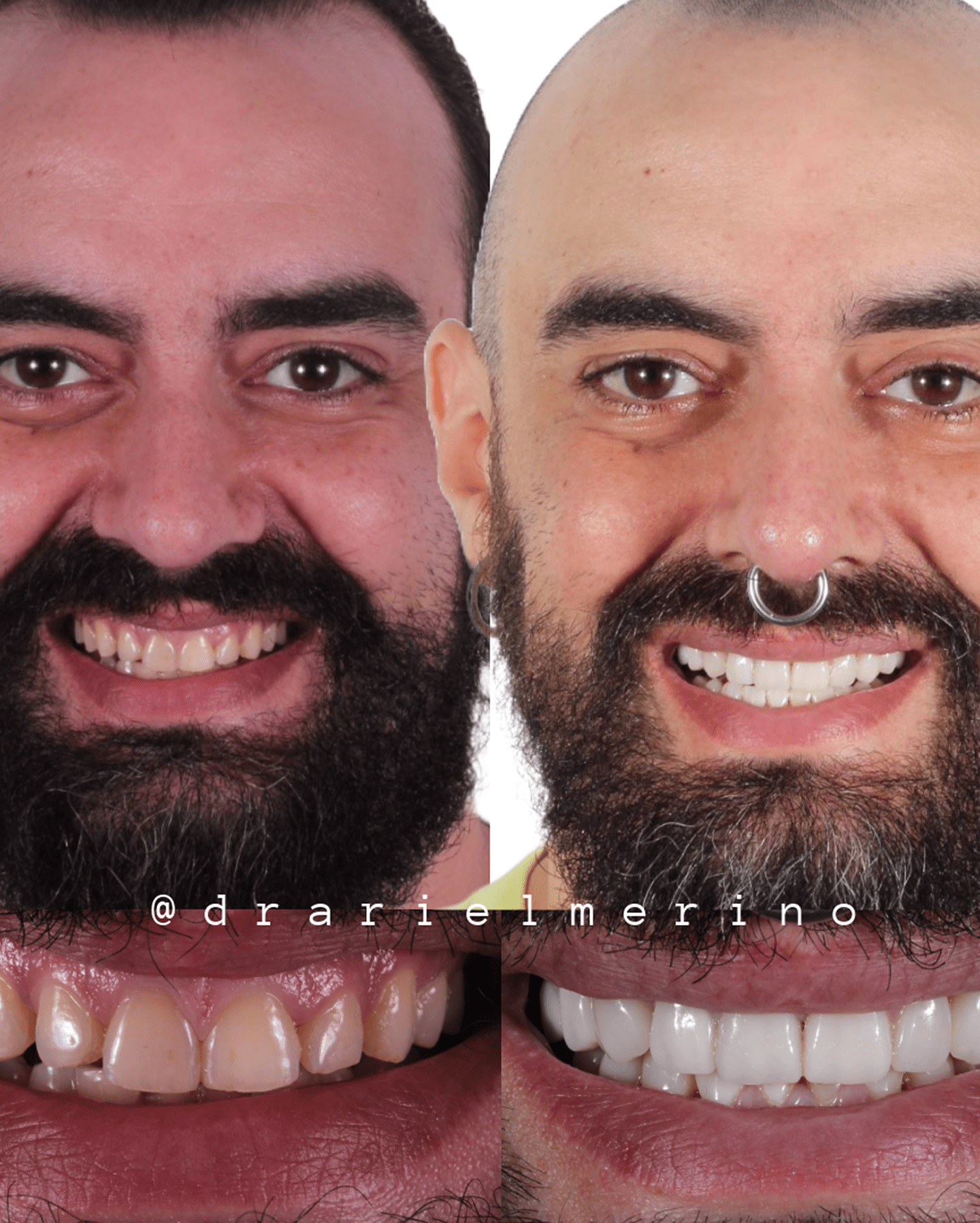 AM esteica dental testimonio