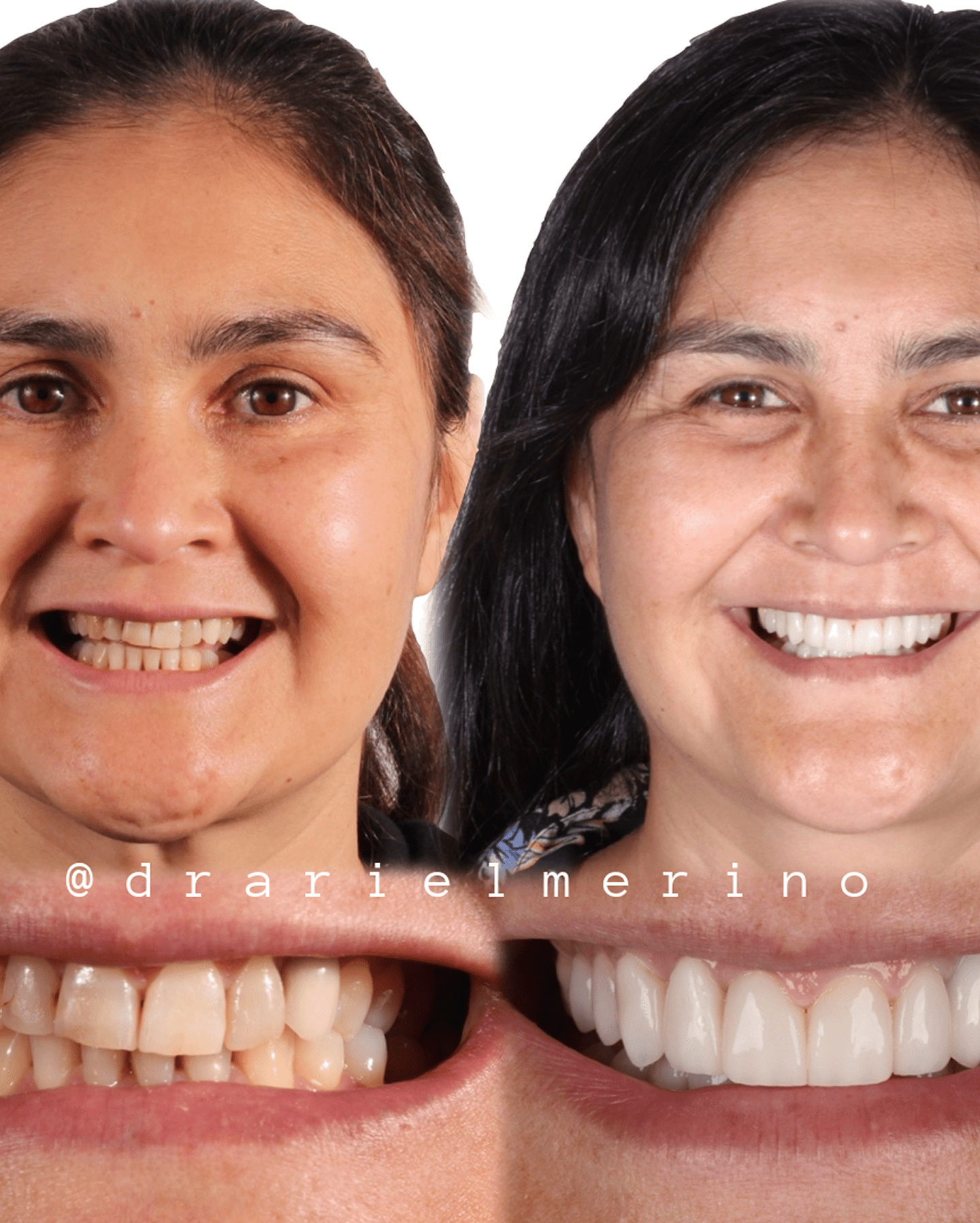 AM estetica dental testimonio 7