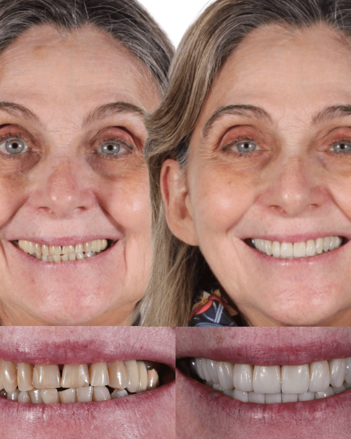 AM estetica dental testimonio Anashi