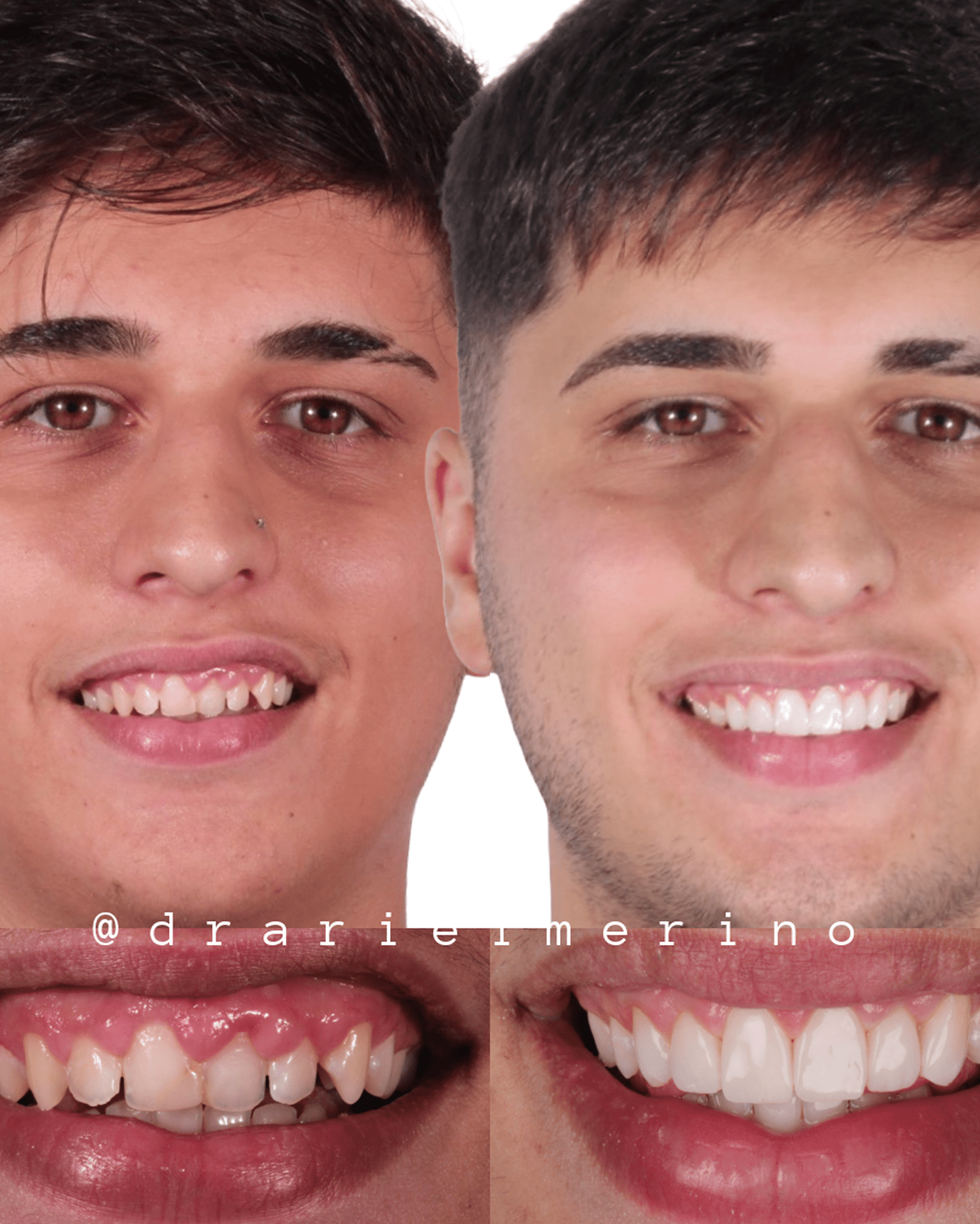 AM estetica dental testimonio Home