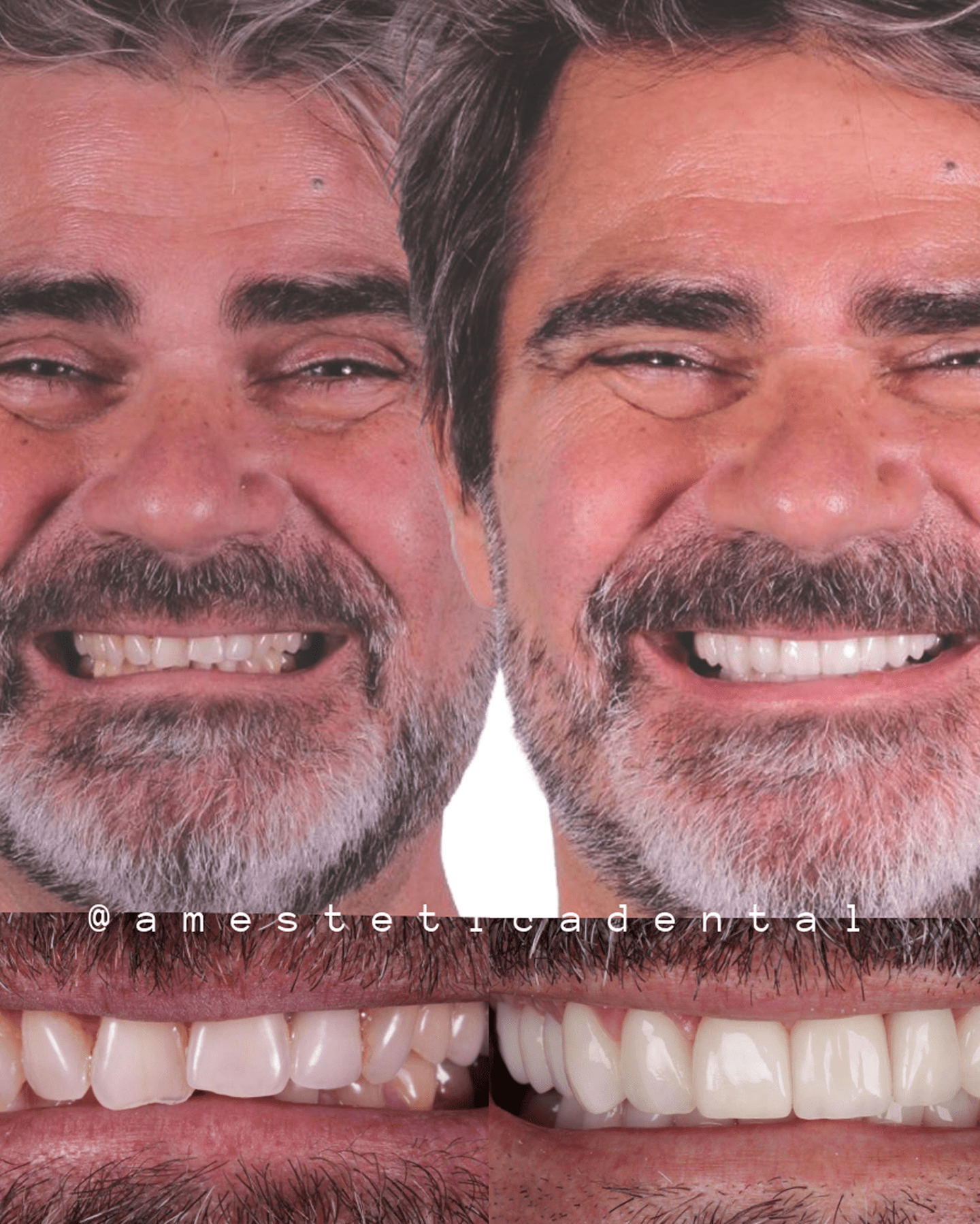 AM estetica dental testimonio home gustavo