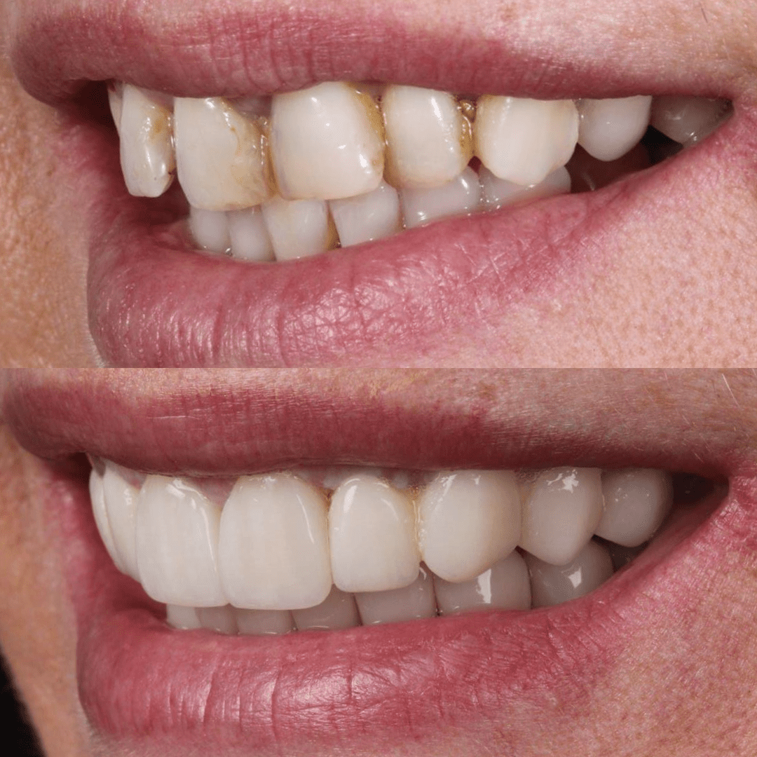 AM estetica dental Malena 2