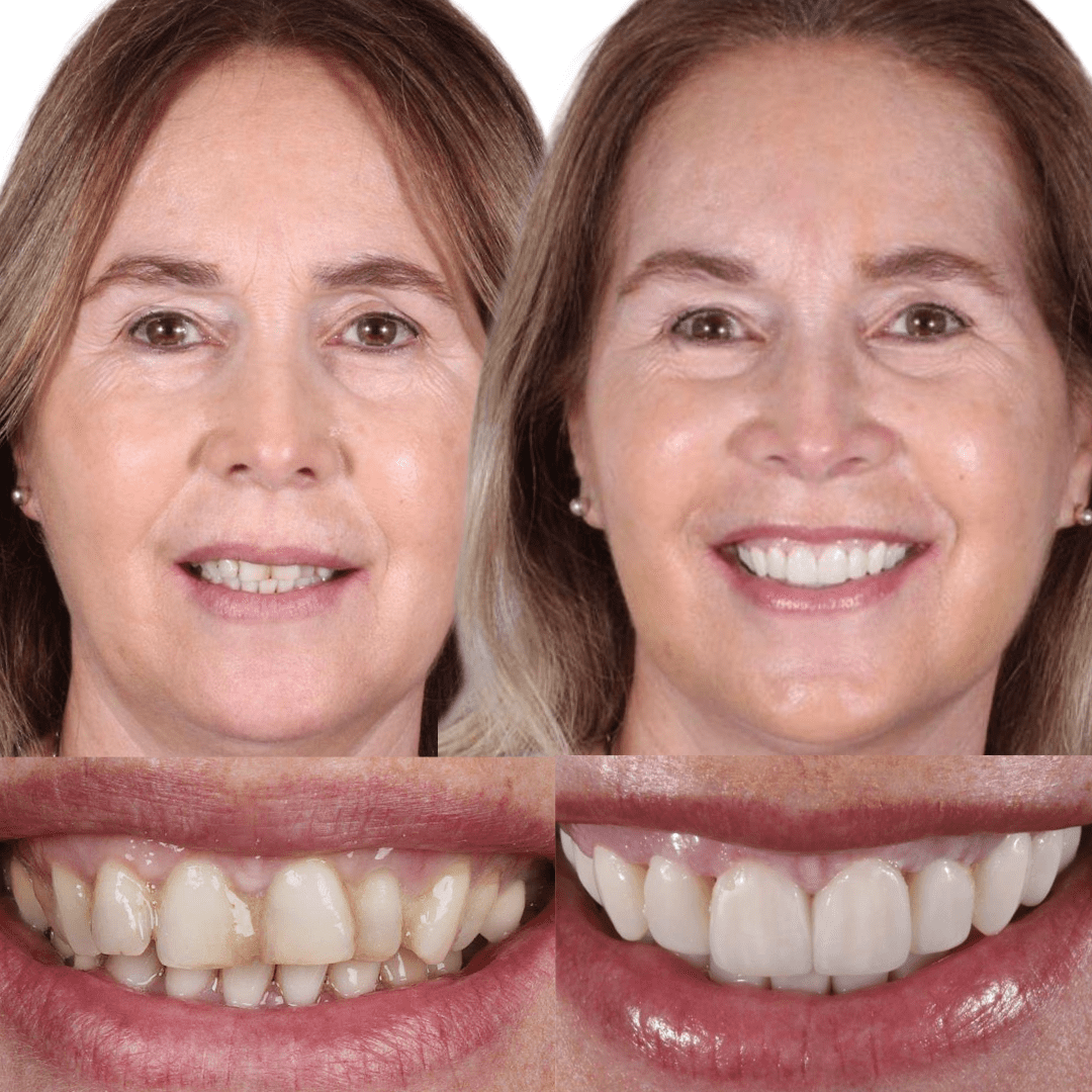 AM estetica dental Malena 4