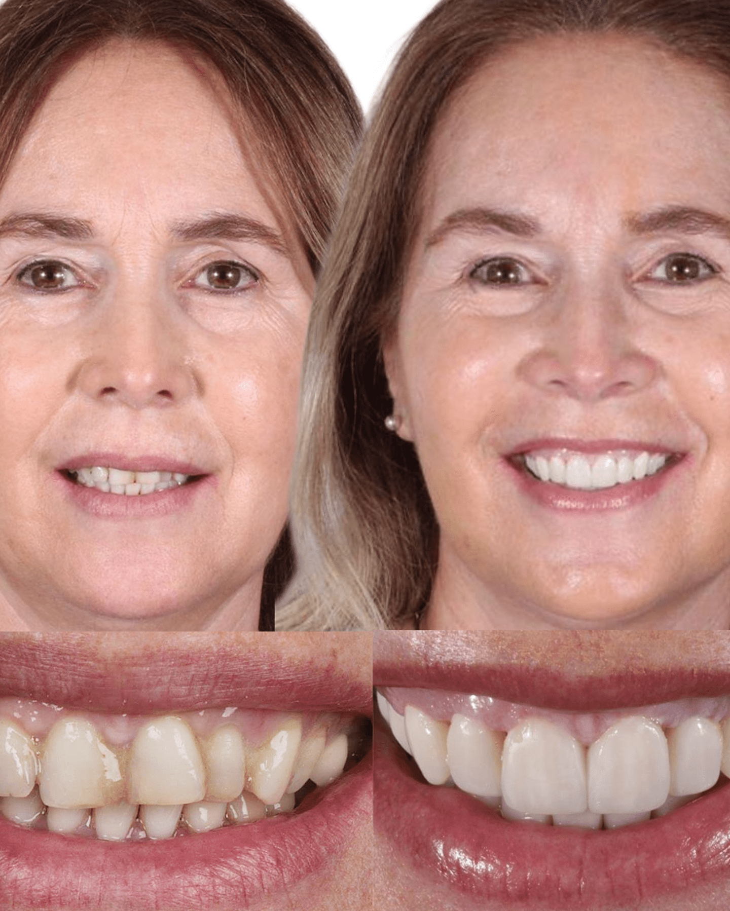 AM estetica dental Malena