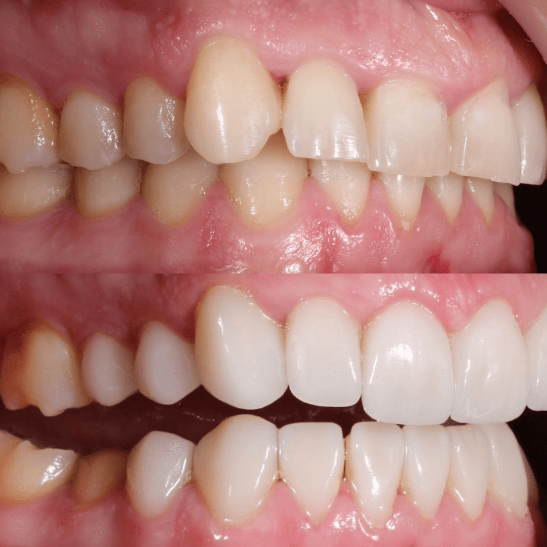 AM estetica dental pac 11 3