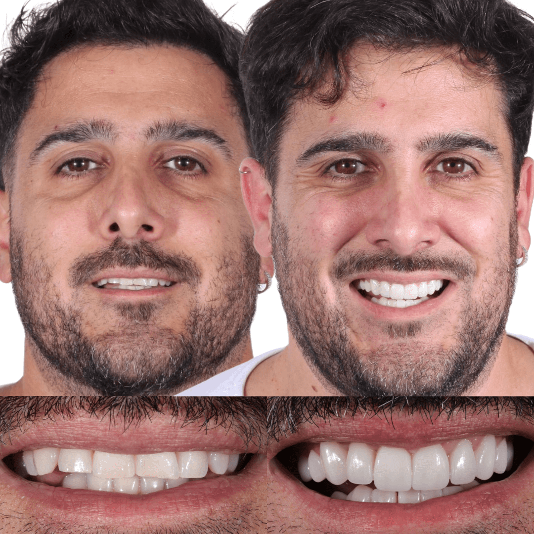 AM estetica dental pac 11