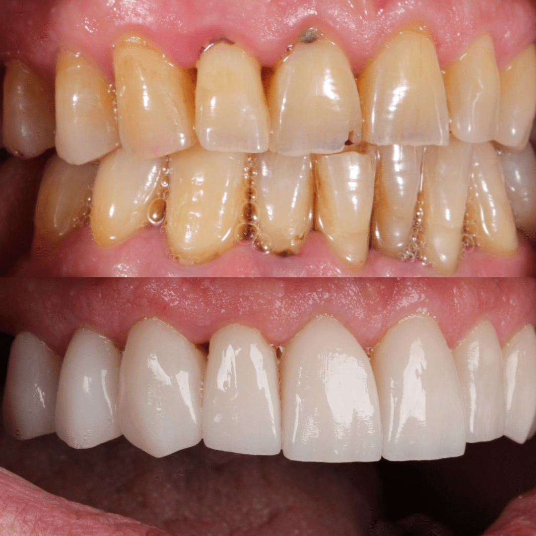 AM testimonio pac 12 1