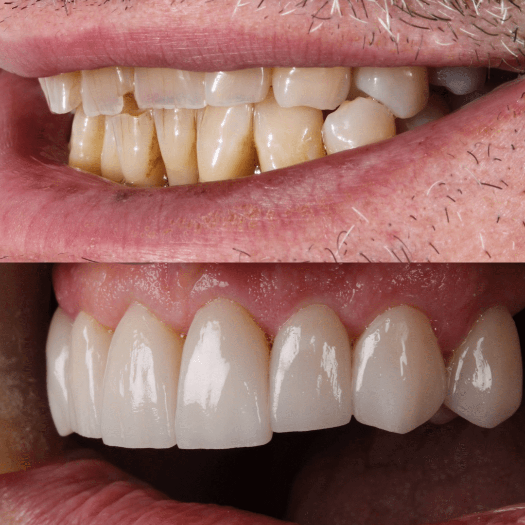 AM testimonio pac 12 3