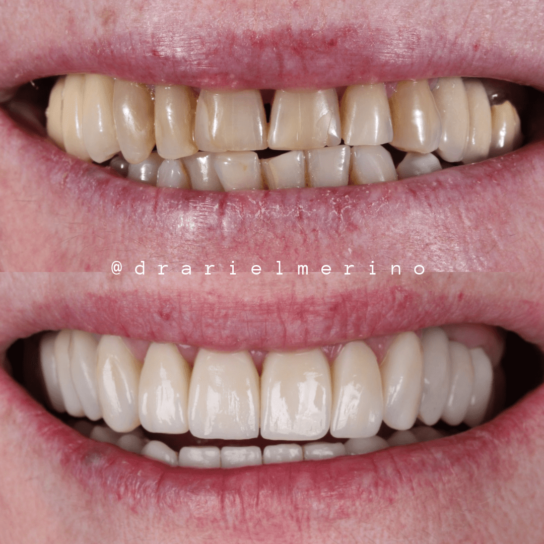 testimonios am estetica dental paciente 8 1