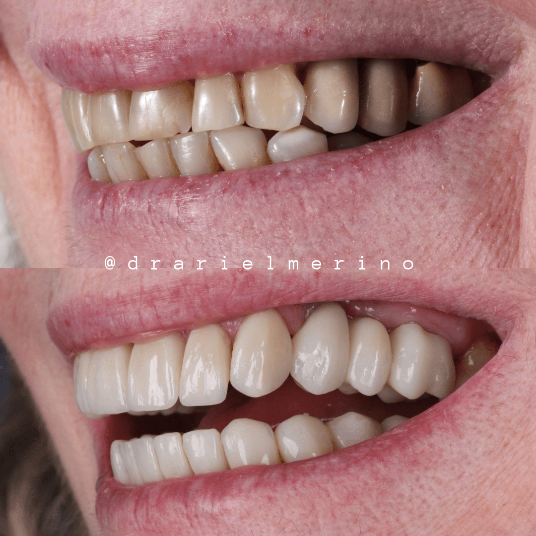 testimonios am estetica dental paciente 8 3