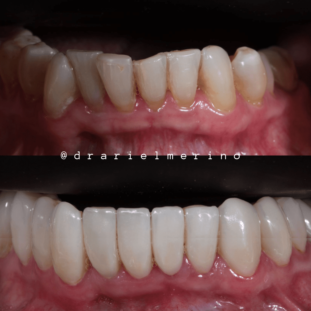 testimonios am estetica dental paciente 8 4