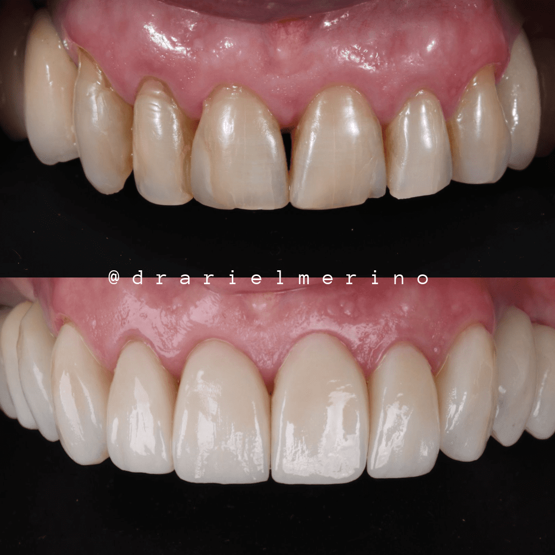 testimonios am estetica dental paciente 8 5