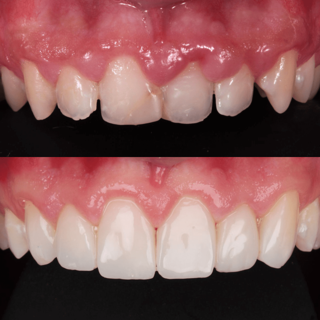 testimonios am estetica dental paciente 9 1