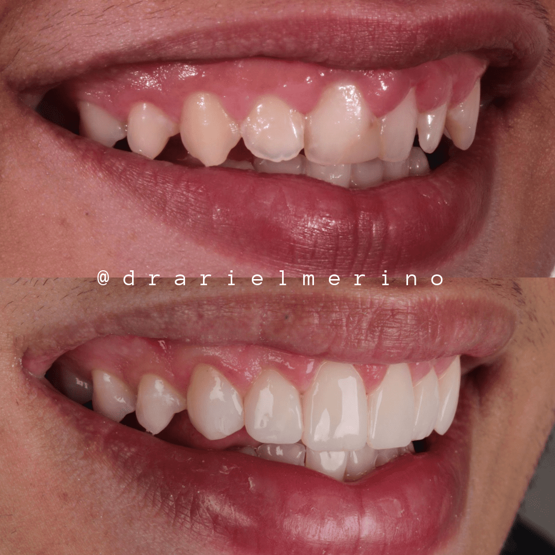 testimonios am estetica dental paciente 9 3