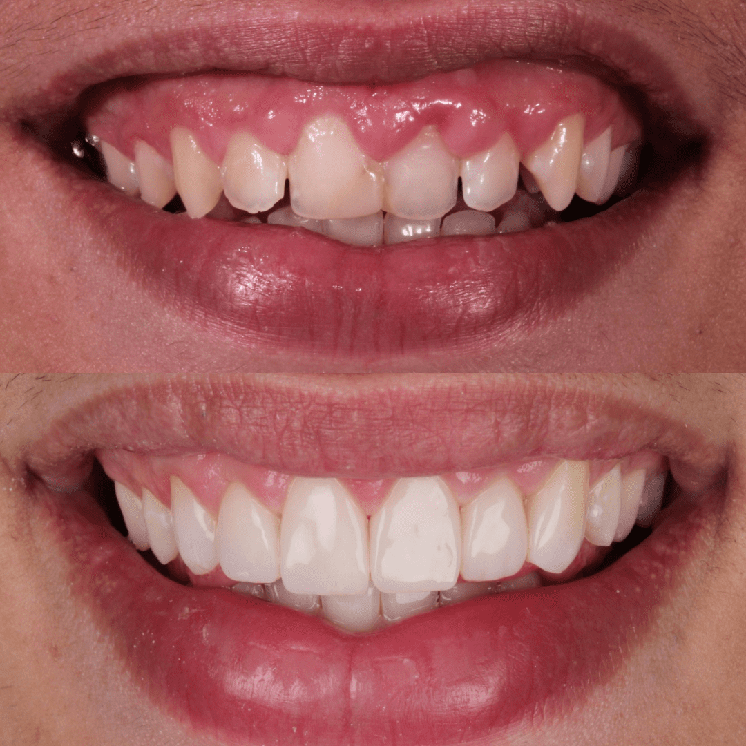 testimonios am estetica dental paciente 9 4